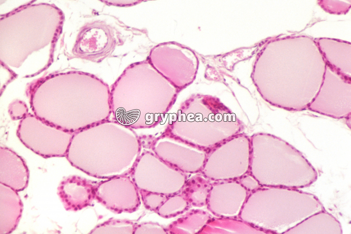 Thyroïde en hypoactivité x40 - gryphea.com